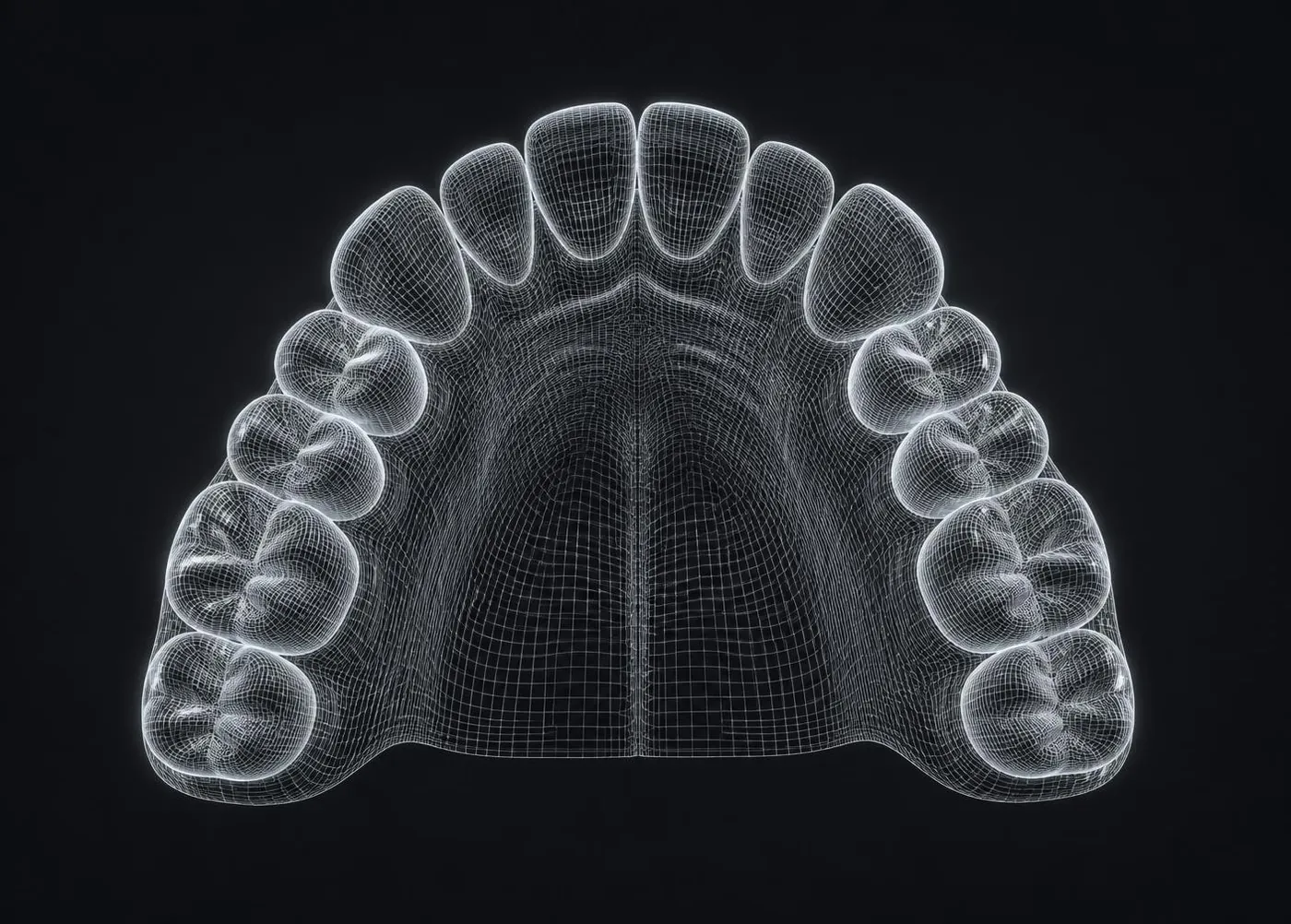 Digital 3D scan of a dental arch used for implant treatment planning